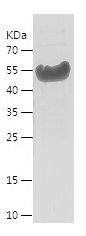    TTR / Recombinant Human TTR