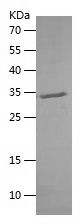 Recombinant bovine IPTH