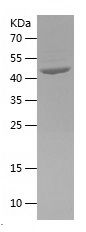    PDIA6 / Recombinant Human PDIA6