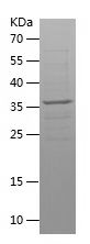    PNMAL1 / Recombinant Human PNMAL1