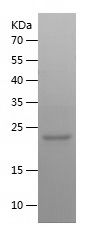    NRAS / Recombinant Human NRAS