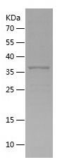    GOLPH3 / Recombinant Human GOLPH3