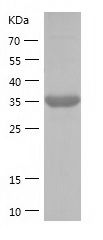    BCAR1 / Recombinant Human BCAR1