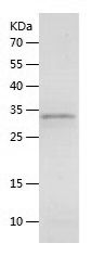    CALCA / Recombinant Human CALCA