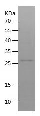    MCPIP-1 / Recombinant Human MCPIP-1