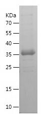    PIM2 / Recombinant Human PIM2