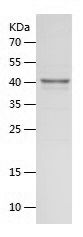    OAS1 / Recombinant Human OAS1