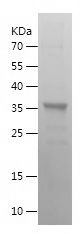    SKIL / Recombinant Human SKIL