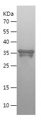    ITGB1 / Recombinant Human ITGB1