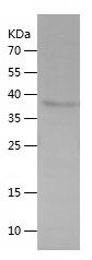    TACC1 / Recombinant Human TACC1