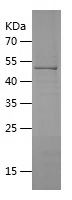    HSD17B11 / Recombinant Human HSD17B11