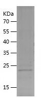    CBFB / Recombinant Human CBFB