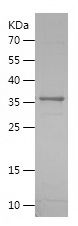    CD57 / Recombinant Human CD57