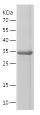    FGFR3 / Recombinant Human FGFR3