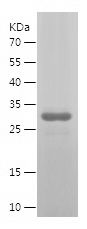    STAT6 / Recombinant Human STAT6