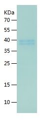    Presepsin / Recombinant Human Presepsin
