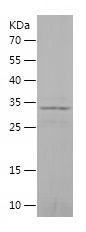    IDE-2 / Recombinant Human IDE-2