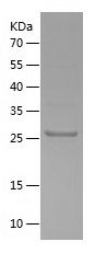    FGF3 / Recombinant Human FGF3