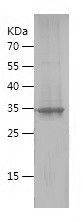    MYEOV / Recombinant Human MYEOV