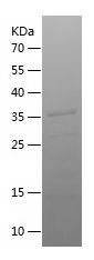    SYNPO2L / Recombinant Human SYNPO2L