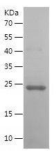    OSM / Recombinant Human OSM