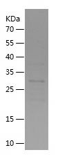    TBC1D22A / Recombinant Human TBC1D22A