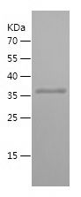    RABEPK / Recombinant Human RABEPK