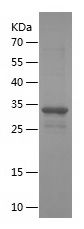    TFAP2B / Recombinant Human TFAP2B