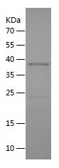    TACC3 / Recombinant Human TACC3