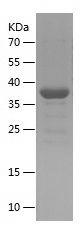    SYNPO2 / Recombinant Human SYNPO2