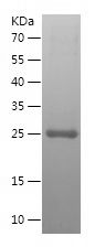    TFAP2E / Recombinant Human TFAP2E