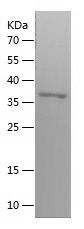    MVP / Recombinant Human MVP