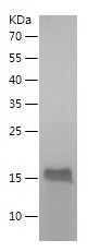    SURVIVIN / Recombinant Human SURVIVIN