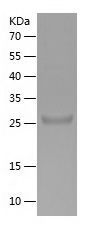    THBS1 / Recombinant Human THBS1