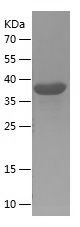    EMILIN1 / Recombinant Human EMILIN1