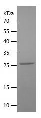Recombinant Mouse CTNI