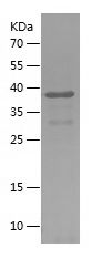    PODXL / Recombinant Human PODXL