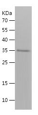    F1+2 / Recombinant Human F1+2