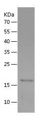 Recombinant Mouse CKM