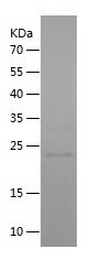    ULBP2 / Recombinant Human ULBP2