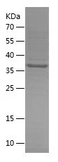    THEM2 / Recombinant Human THEM2