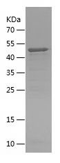    AHI1 / Recombinant Human AHI1