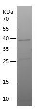    GYPC / Recombinant Human GYPC