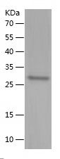    UHRF1 / Recombinant Human UHRF1