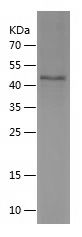    ASB17 / Recombinant Human ASB17