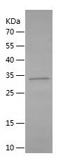    CD21 / Recombinant Human CD21