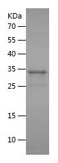    HSD17B3 / Recombinant Human HSD17B3