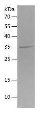    TBC1D5 / Recombinant Human TBC1D5