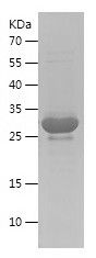    AQP4 / Recombinant Human AQP4