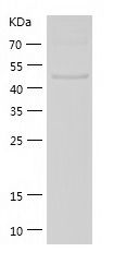 hRecombinant Mouse HGF